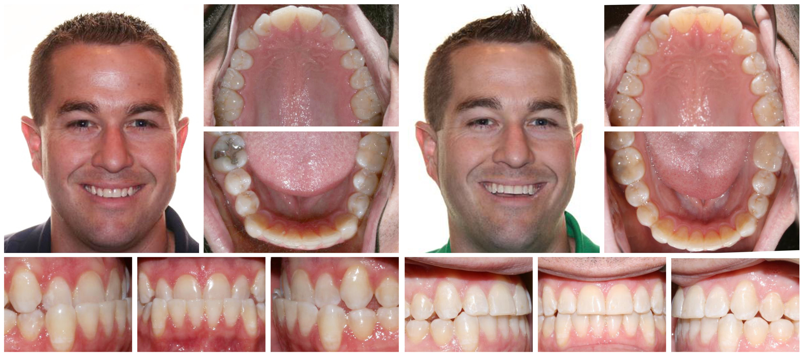 Adultmale-composite_2_9_2023_12_00_13_PM